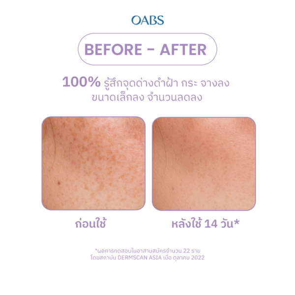 OABS Anti Melasma Spotless Brightening Booster Serum 15g - Image 8